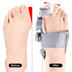 Bunion Corrector with Adjustable 3D Knob and Heel Strap, Universal Size