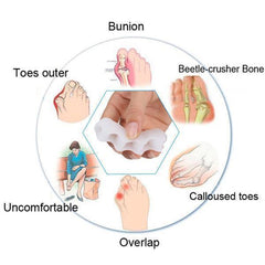 Toe Corrector Sleeve with Gel Pad Cushioning and Adjustable Strap, Arch Support